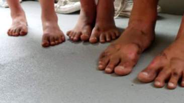 My childrens feet after marching all day in DC